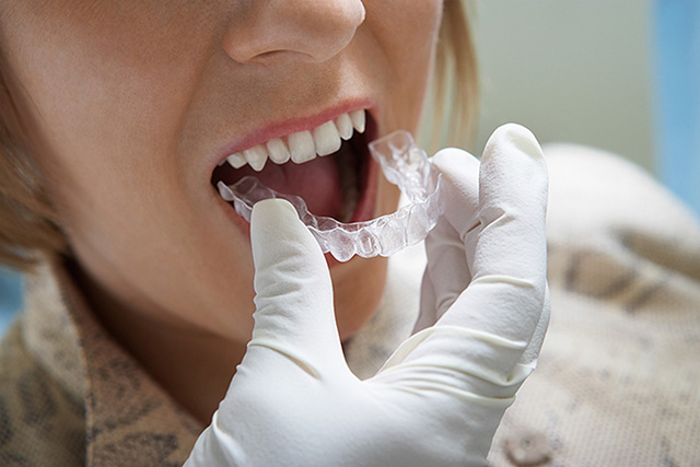 soak retainer head braces