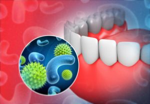 tooth bacteria could cause sore throat and neck pain