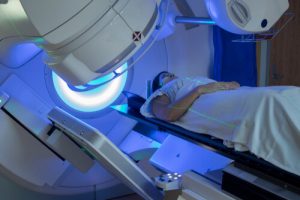 radiation for head and neck cancer