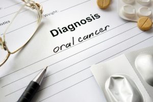 velscope oral cancer screening